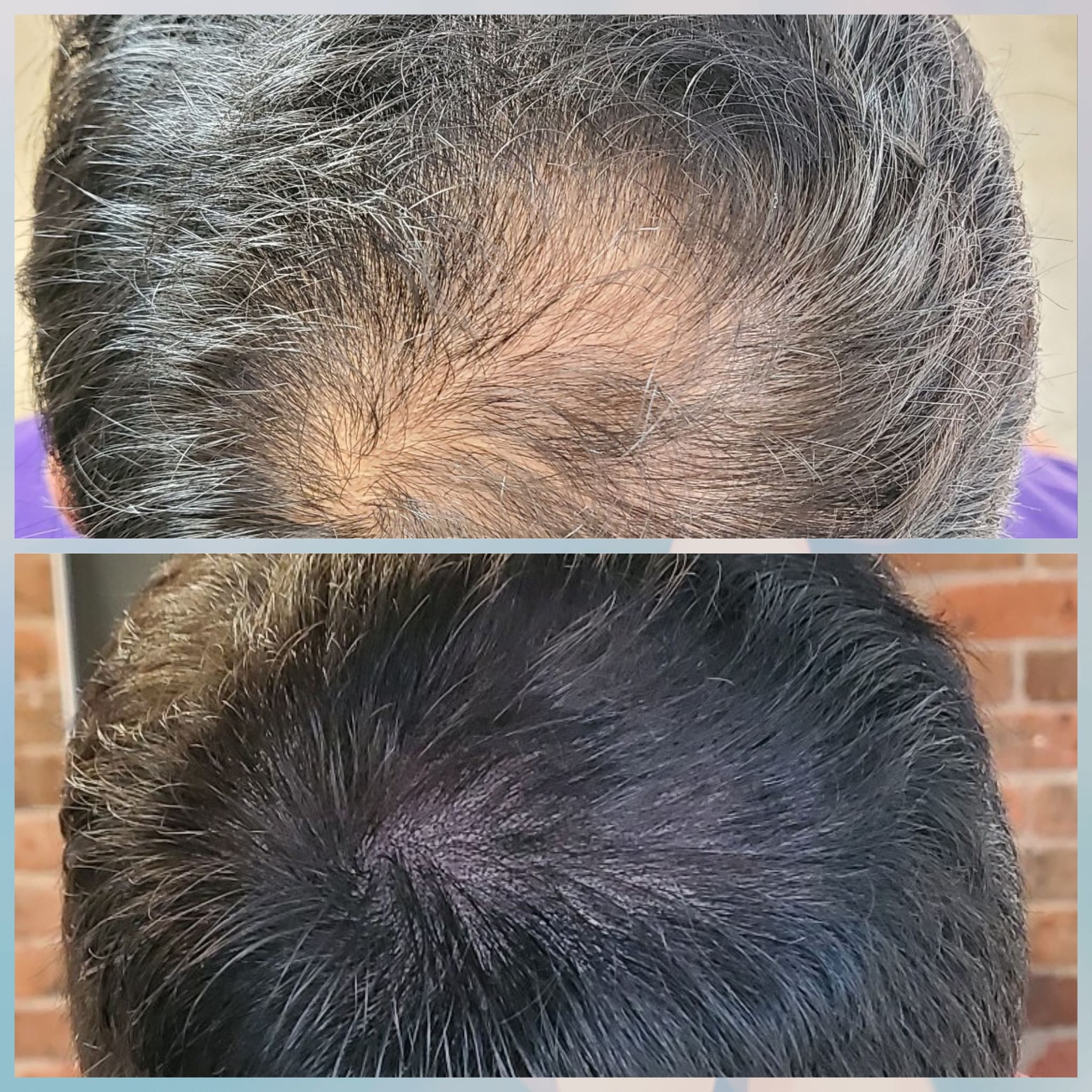 Men SMP Density 2-min