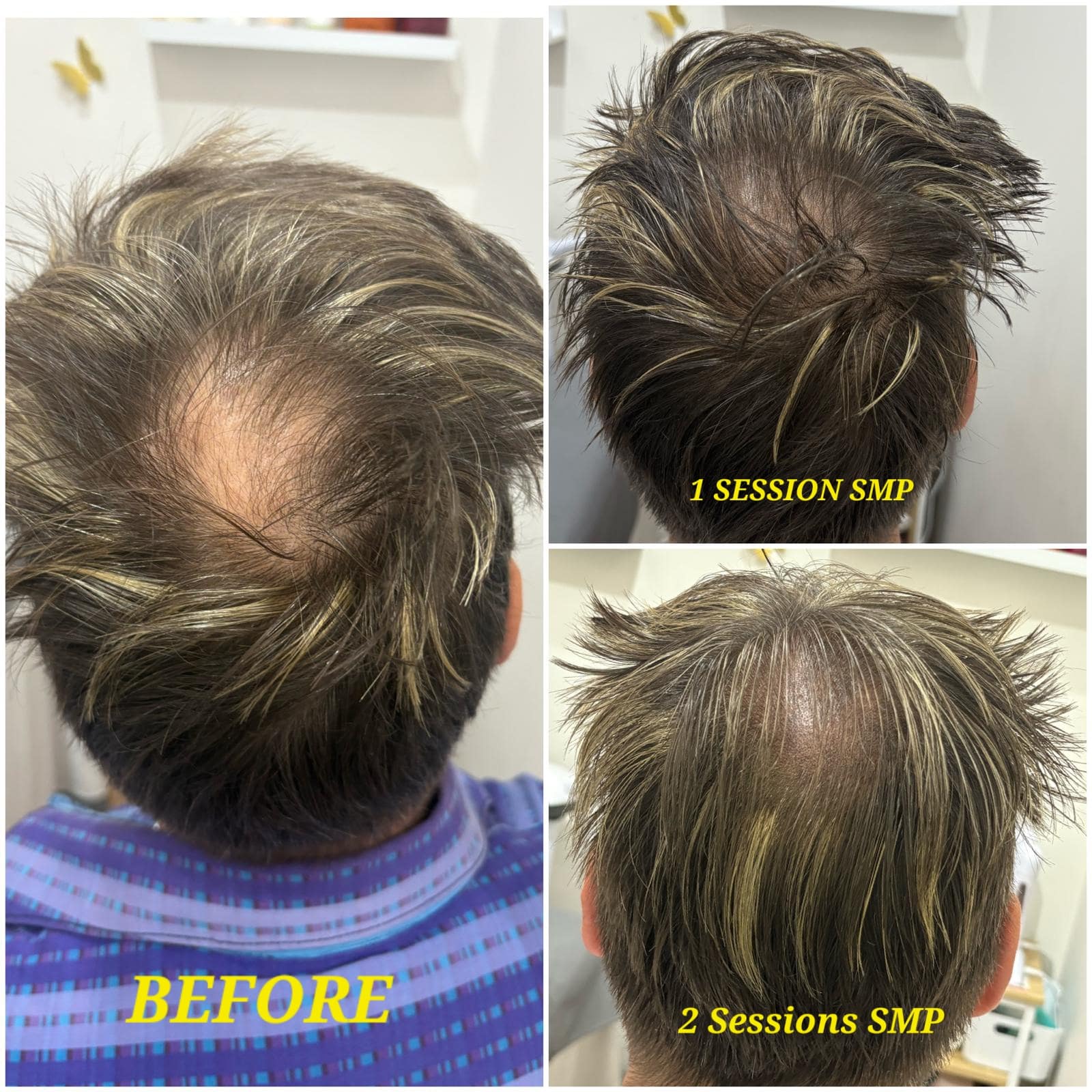 Men SMP Density 7-min